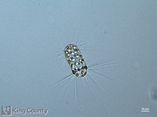 Photo of Corethron hystrix